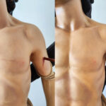 Comparativa del antes y el después de la restauración