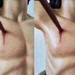 Comparativa del antes y el después de la restauración