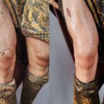 Comparativa del antes y el después de la restauración